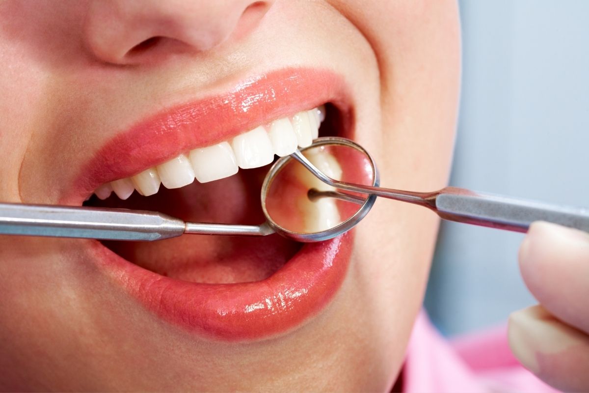 Teeth Cleaning in Alanya | Affordable & Gentle Dental Care Teeth Cleaning in Alanya 2025
